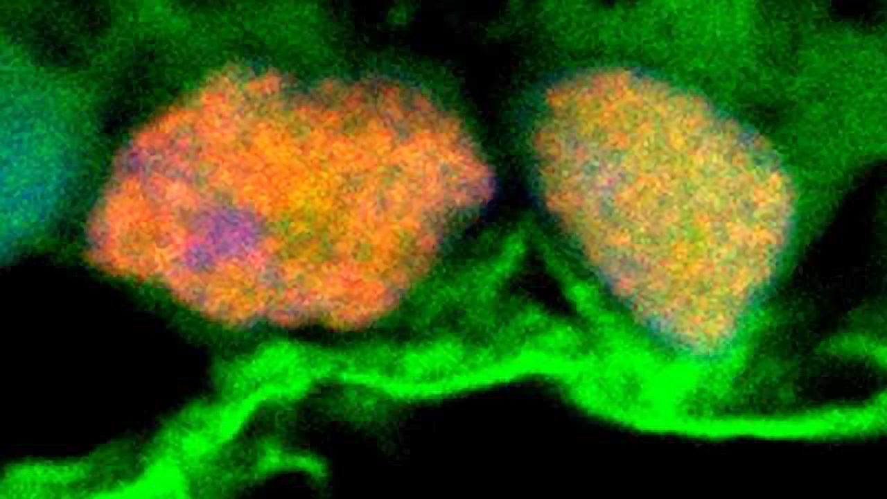 Exosomes Could Protect Against Glaucoma