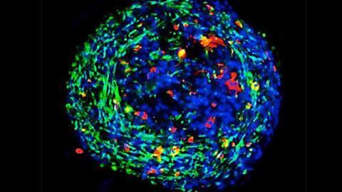 Mini-lungs to Predict Antifibrotic Drug Response