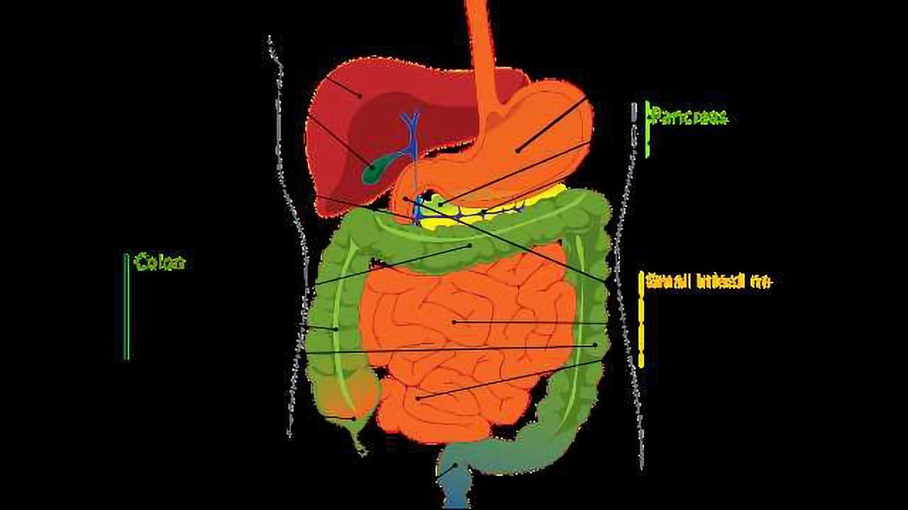 Sensor Developed for Identifying Inflammatory Bowel Disease and Its Two Subtypes