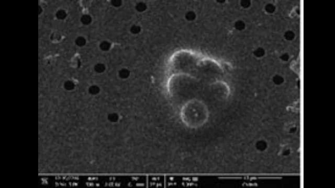 Incorporation of the Quorum Cryo-SEM System in Cell Biology with Electron Cryotomography