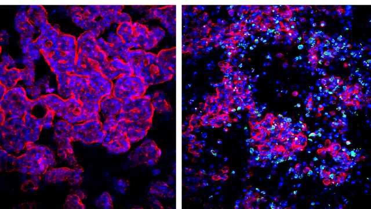 Gut-on-a-Chip Models Enterovirus Infection