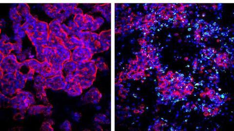 Gut-on-a-Chip Models Enterovirus Infection