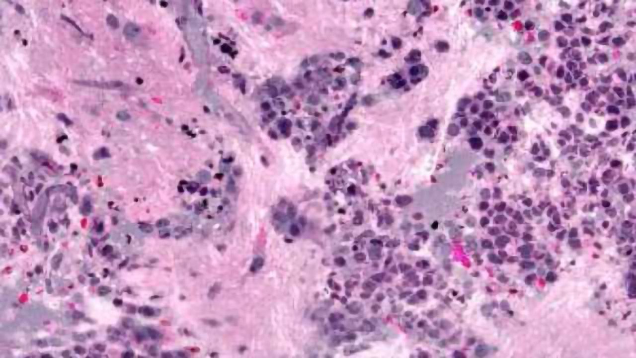 Faster Diagnosis During Brain Surgery