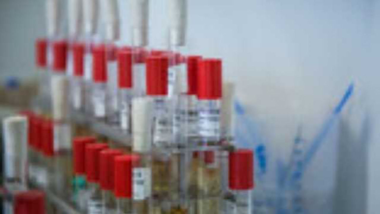 Rapid Test Detects Colistin Resistance Gene