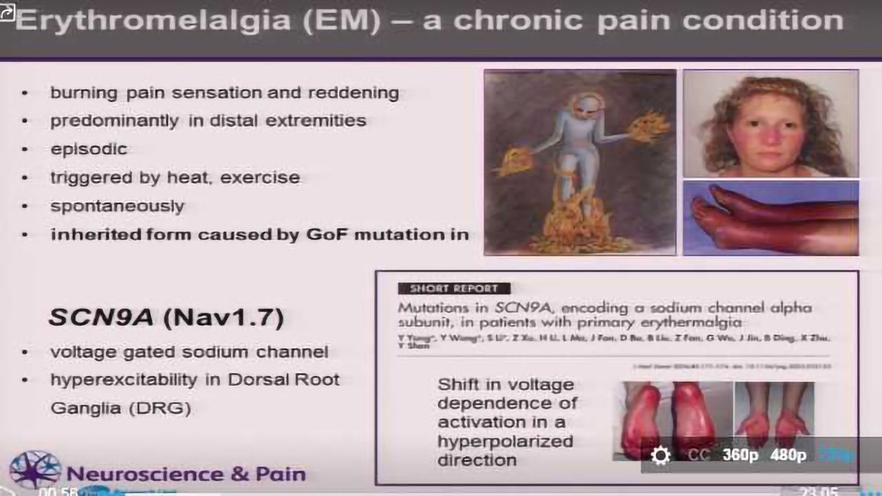 Modelling A Chronic Pain Condition In A Dish