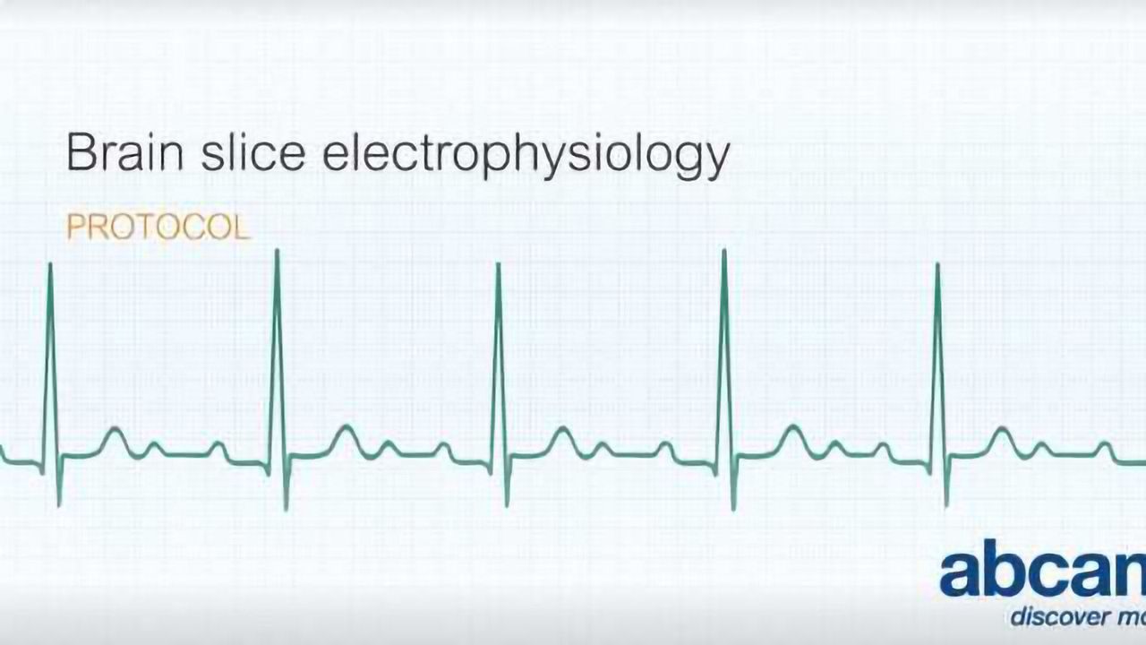 Brain Slice Electrophysiology
