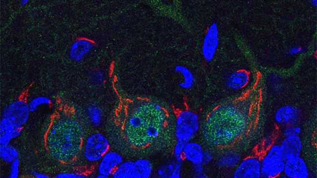 Disabling the Protein Tap Causes Neurodegeneration