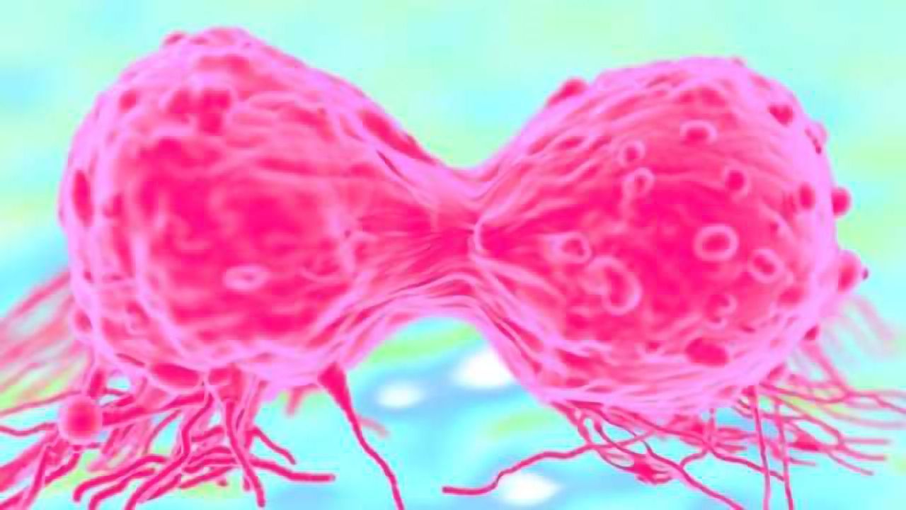 Immune System Plays Key Role in Early Breast Cancer Development