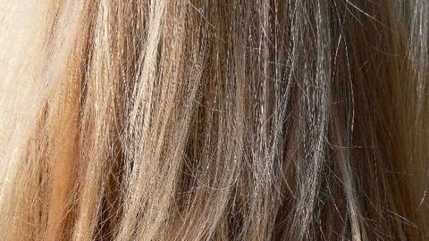 Diagnosing Cushing Syndrome with Hair Analysis