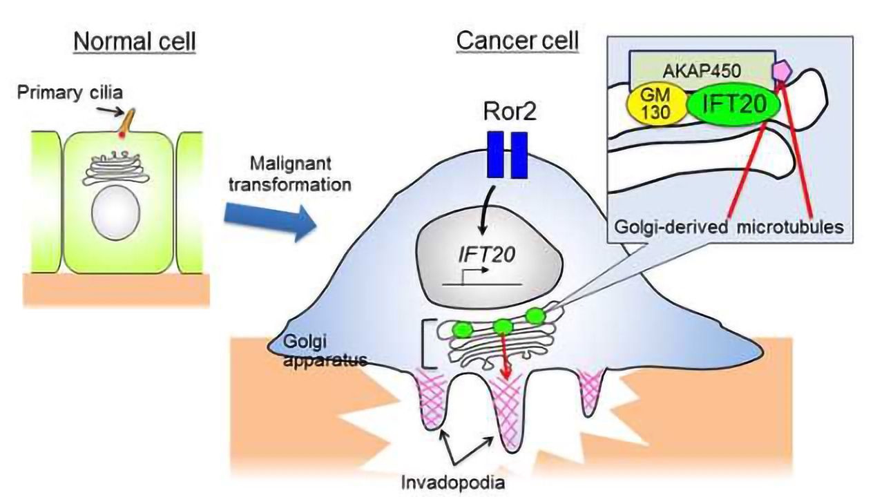 IFT20 Protein Helps Cancer Cells to Invade