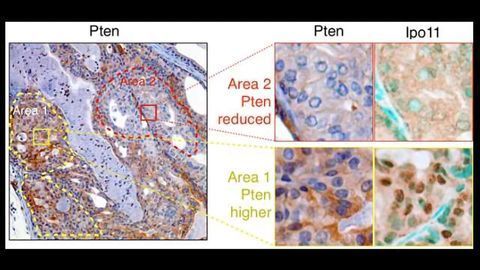 Achilles Heel of Cancer Preventing Protein Discovered