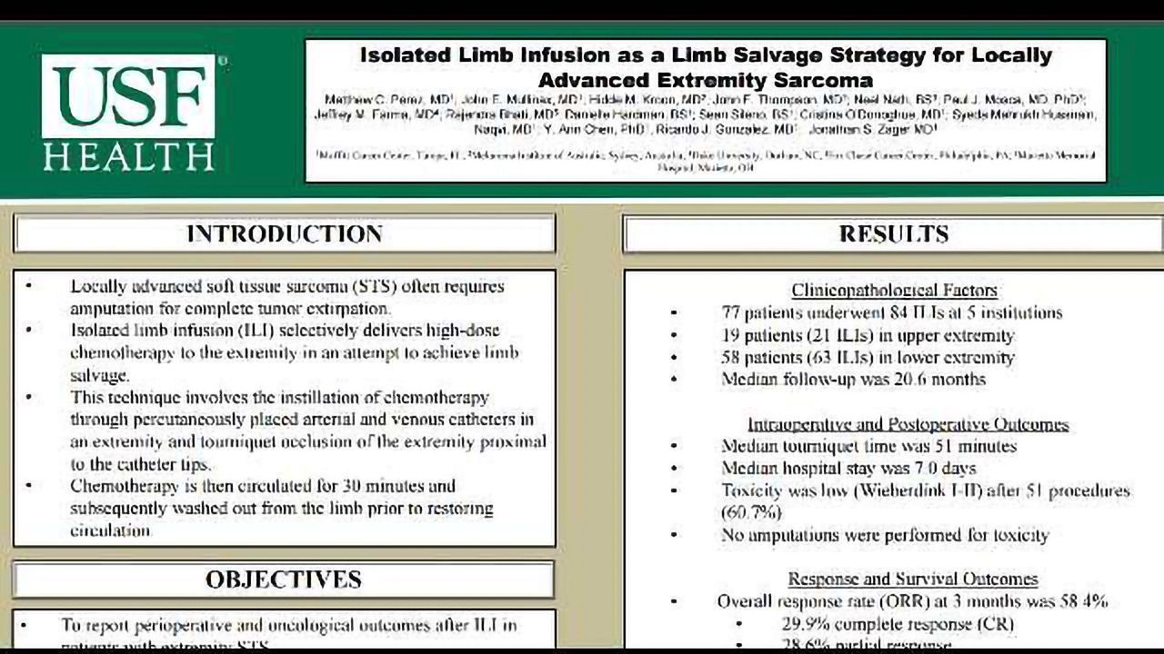 Isolated Limb Infusion as a Limb Salvage Strategy for Locally Advanced Extremity Sarcoma