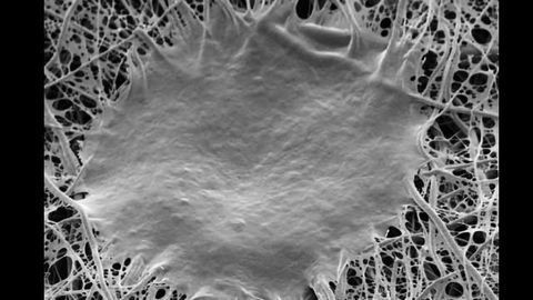 A Nanofiber Matrix for Healing