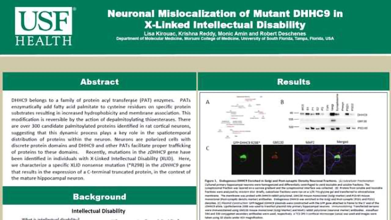 Neuronal Mislocalization of Mutant DHHC9 in X-Linked Intellectual DIsability