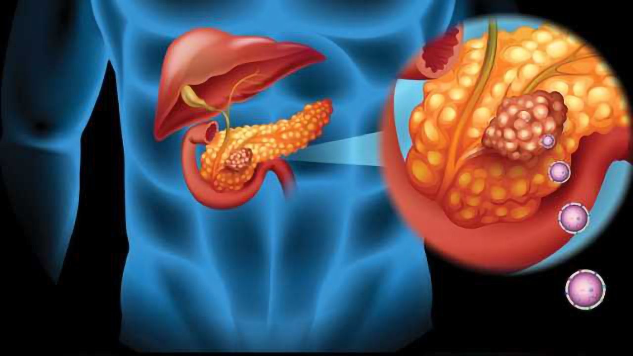 Innovative Nanotechnology for Cancer Diagnostics