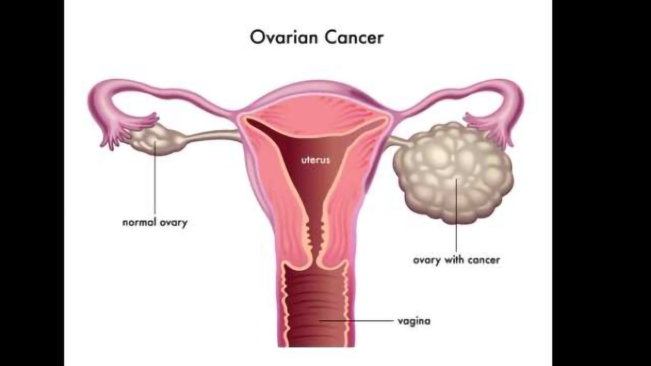 Uncovering an Often Overlooked Aspect of Cancer Genetics