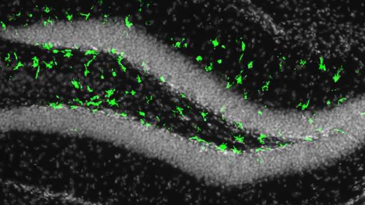 Zika infection may affect adult brain cells