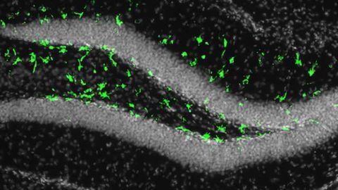 Zika infection may affect adult brain cells