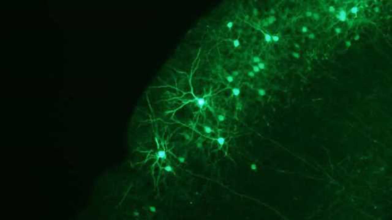 Turning to the brain to reboot computing