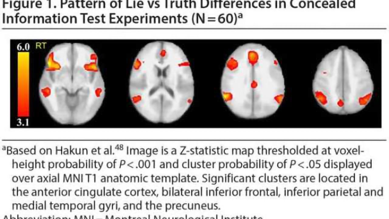 Illuminating lies with brain scan outshines polygraph test, study finds