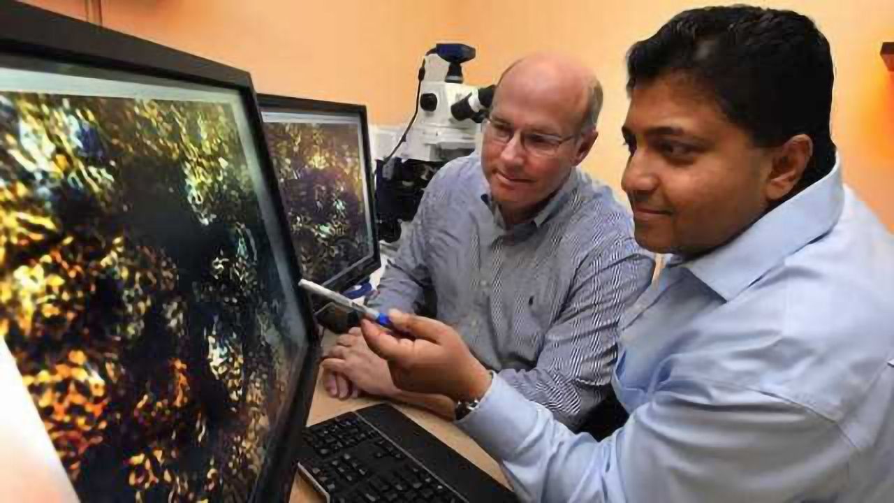 Metabolite of multiple sclerosis drug could be safe, effective therapy for Parkinson's disease