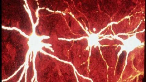 ALS-linked gene causes disease by changing genetic material's shape