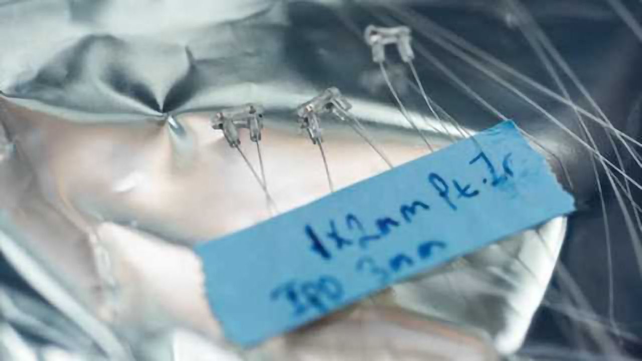 Buzzing the vagus nerve just right to fight inflammatory disease