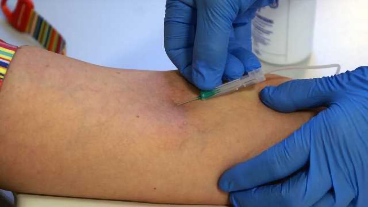 Blood test identifies those at-risk for cognitive decline, Alzheimer's within three years