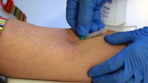Blood test identifies those at-risk for cognitive decline, Alzheimer's within three years