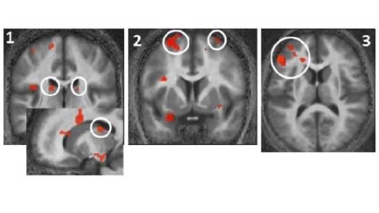 Photic memory for executive brain responses