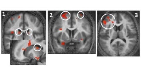 Photic memory for executive brain responses
