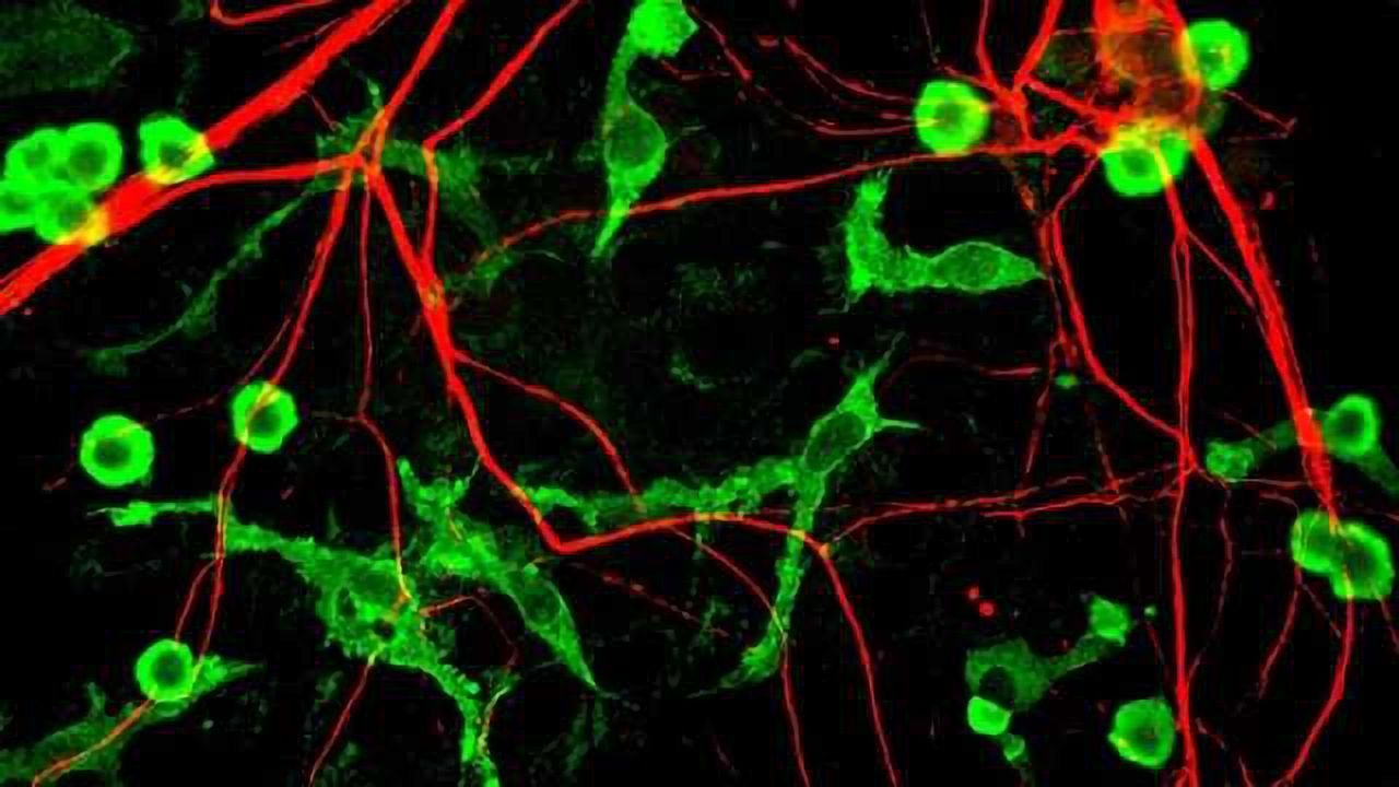 Scientists catch brain damage in the act