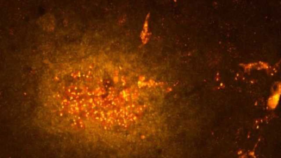 Stem cell combination therapy improves traumatic brain injury outcomes according to study content piece image