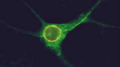New clue to autism found inside brain cells