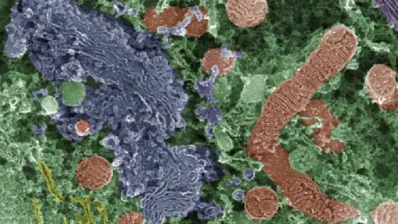 Study demonstrates those who suffer from Gulf War Illness, including its cognitive symptoms, have imparied mitochondrial function