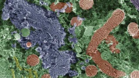 Study demonstrates those who suffer from Gulf War Illness, including its cognitive symptoms, have imparied mitochondrial function