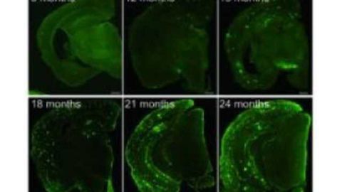 New mouse model could revolutionize research in Alzheimer's disease New mouse model could revolutionize research in Alzheimer's disease