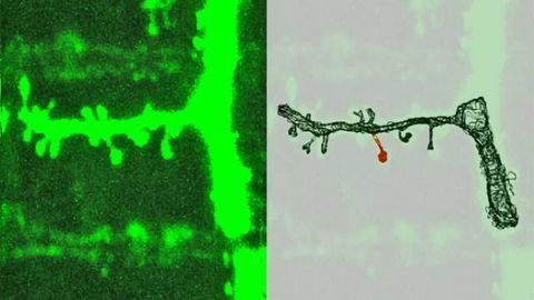 Synapses: Stability in transformation Synapses: Stability in transformation
