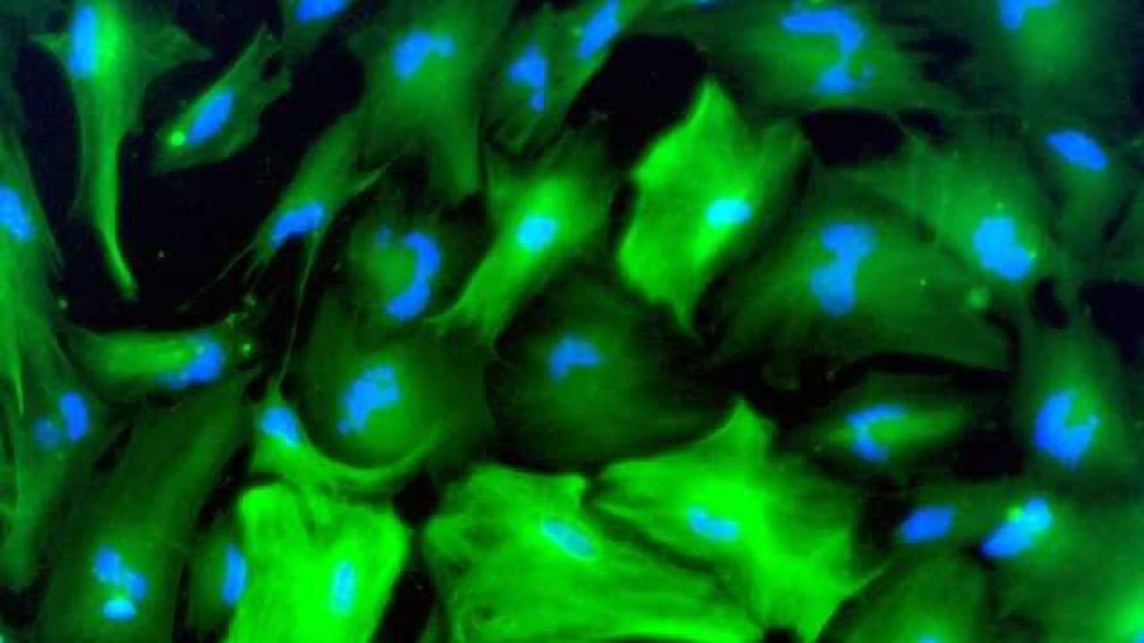 Study shows astrocytes hold keys to brain organization and disease