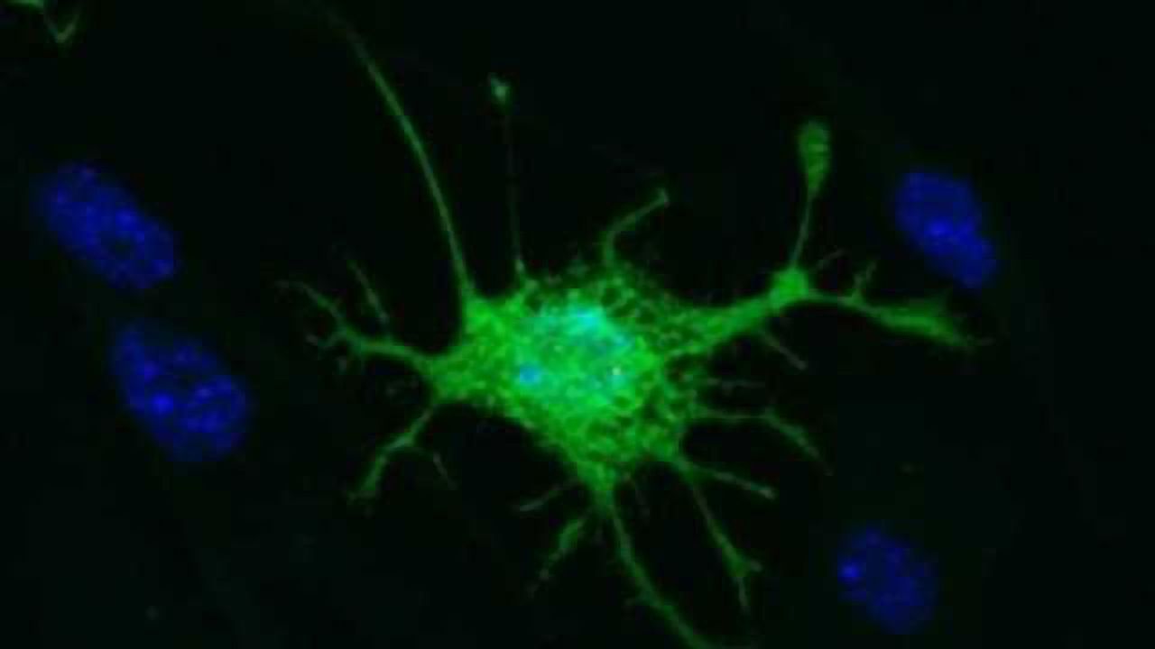 Stem cells from teeth can make brain-like cells