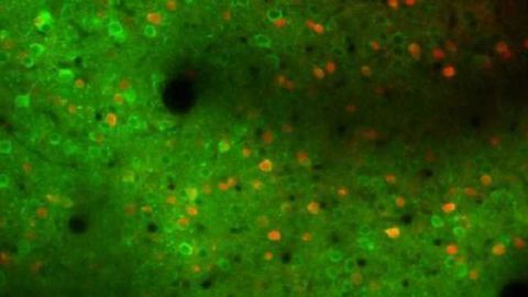 Motor cortex shown to play active role in learning movement patterns Motor cortex shown to play active role in learning movement patterns