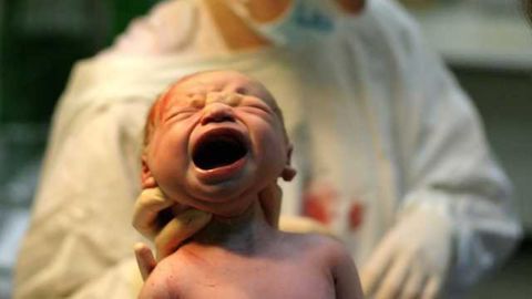 Being born 4-6 weeks premature can affect brain structure, function Being born 4-6 weeks premature can affect brain structure, function