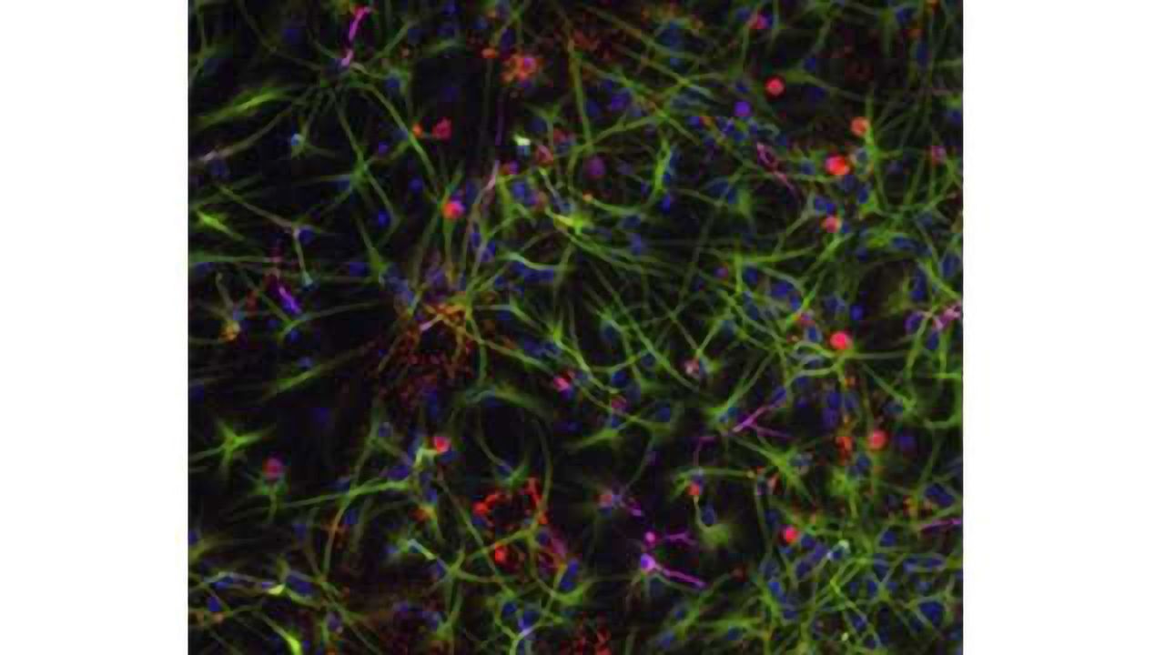 Mouse study offers new clues to cognitive decline