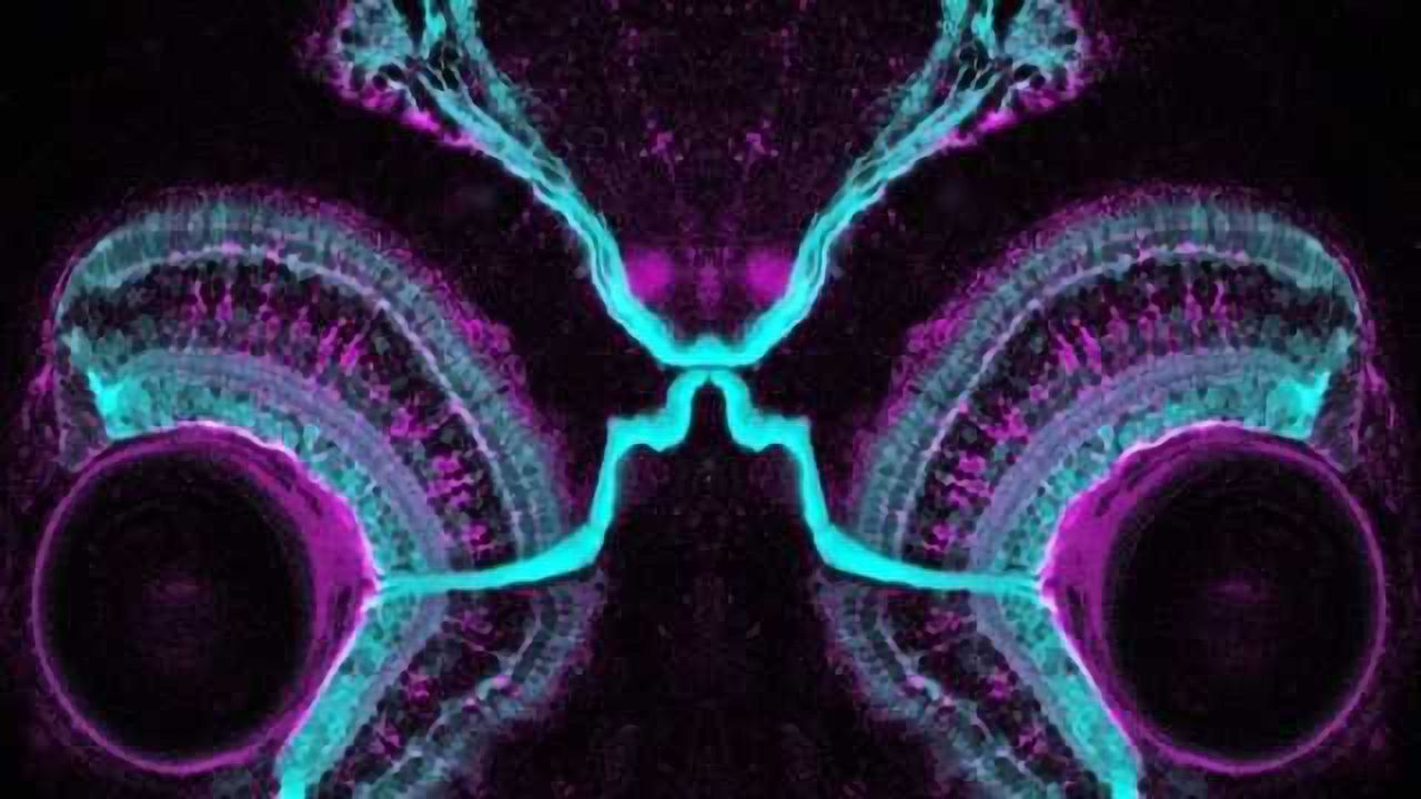 Elevating brain fluid pressure could prevent vision loss
