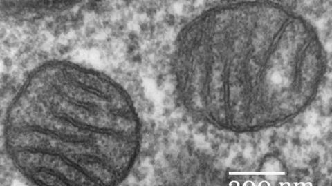 Mitochondrial deficits in children with autism confirmed Mitochondrial deficits in children with autism confirmed