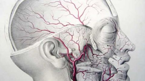 Study examines association between small-vessel disease, Alzheimer pathology