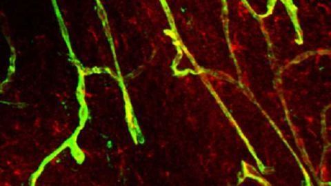 Mechanism offers new insight into opening & closing the blood-brain barrier Mechanism offers new insight into opening & closing the blood-brain barrier
