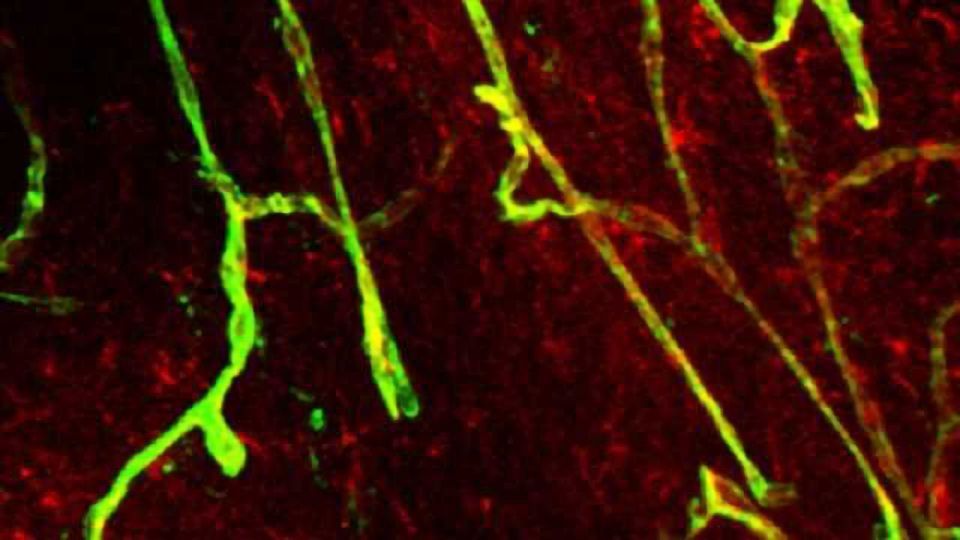 Mechanism offers new insight into opening & closing the blood-brain barrier content piece image