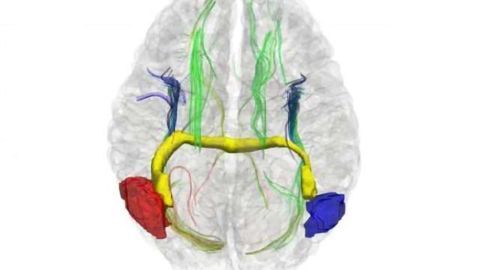Alternative pathways let right and left communicate in early split brains