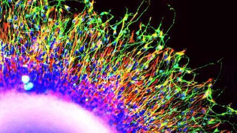New stem cell research points to early indicators of schizophrenia New stem cell research points to early indicators of schizophrenia